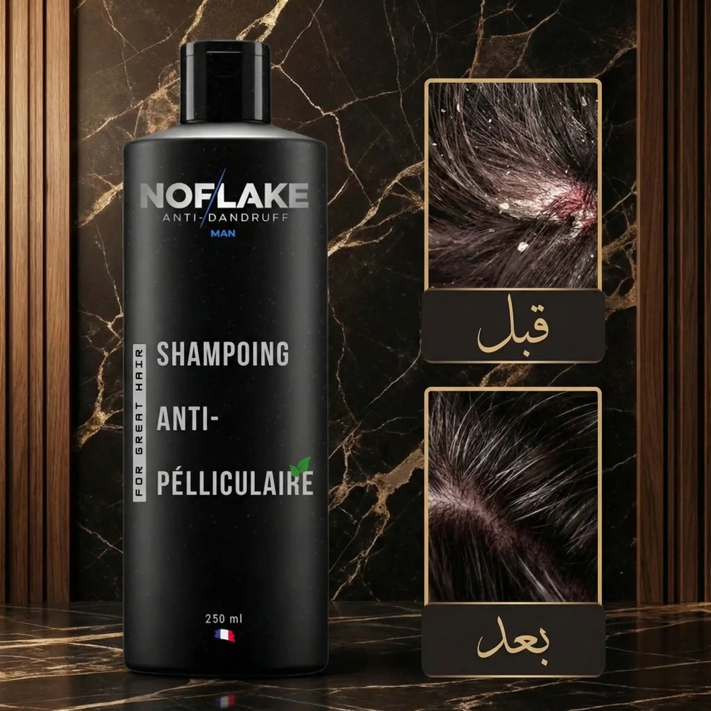 شامبو No Flake للقشرة