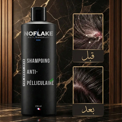 شامبو No Flake للقشرة